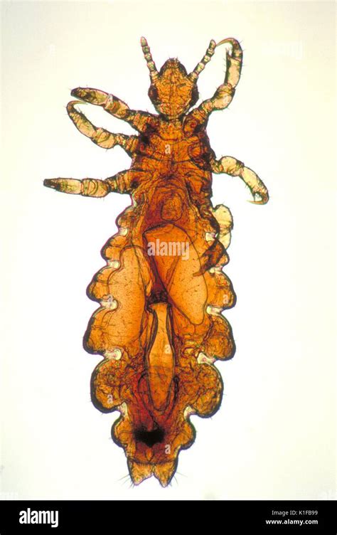 Human Body Louse Hi Res Stock Photography And Images Alamy