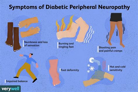 Diabetic Peripheral Neuropathy Causes Symptoms