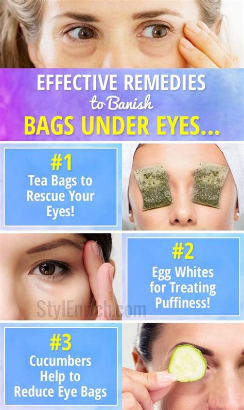 How To Lighten Bags Under Eyes Naturally Dakine Sydney Bag