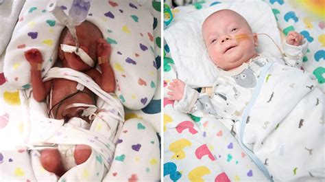 One Pound Premature Baby Heads Home After 124 Days In Nicu