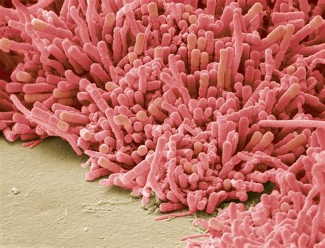 Você Sabia Que Existem Mais De 700 Espécies De Bactéria Na Sua Boca