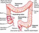 Colostomy Medical Definition Images