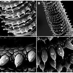 Scanning Electron Micrographs Of Sensory Structures Found On The Antennal Body