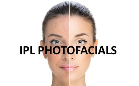 Ipl Photofacials Cover Photo For Website Revive Laser And Skin Clinic