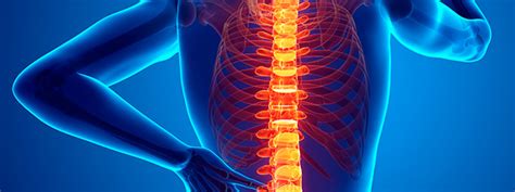 Cirurgia Na Coluna Perguntas Frequentes Dr Alberto Gotfryd