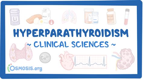 Hyperparathyroidism Clinical Sciences Osmosis Video Library