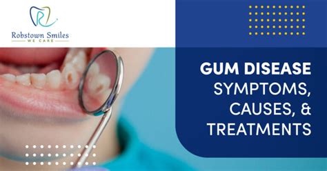 Gum Disease Symptoms Causes And Treatments