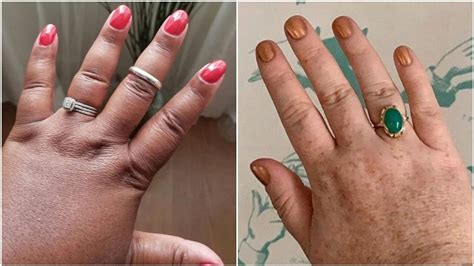 Chubby Fingers Are Getting Their Due Thanks To Social Media Movement Huffpost Life