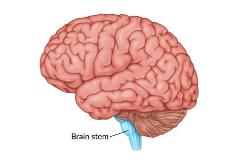 Brain Stem Stroke How It Affects The Body And What To Expect