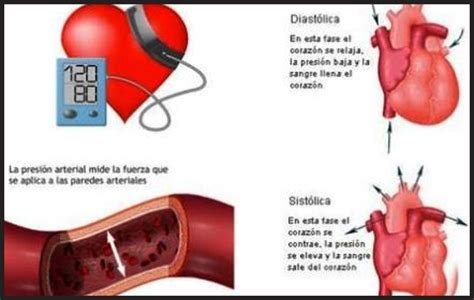 PresiÓn Arterial TÉcnica De MediciÓn