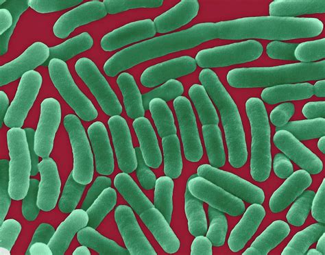 Continuing public health challenge // clinical infectious diseases. Salmonella Typhi Photograph by Dennis Kunkel Microscopy/science Photo Library