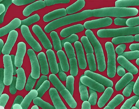 Salmonella cdc estimates salmonella bacteria cause about 1.35 million infections, 26,500 hospitalizations, and 420 deaths in the united states every year. Salmonella Typhi Photograph by Dennis Kunkel Microscopy ...