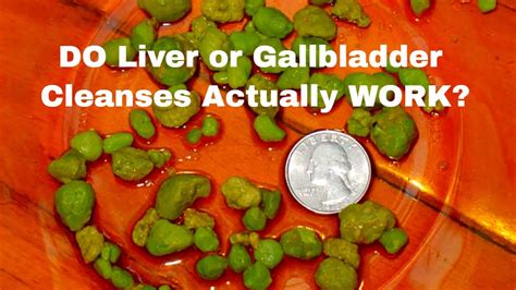 Do Liver Or Gallbladder Cleanses Actually Work Youtube