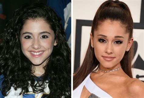 Ariana Grandes Before And After Photos Prove That She Had Plastic