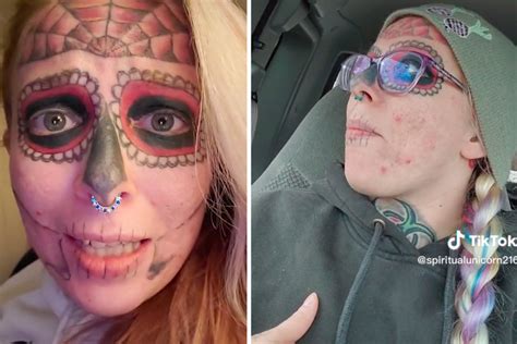 Woman With Jarring Face Tattoos Endures Painful Removal Sessions For A