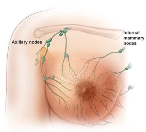 The Medical Research Everything You Need To Know About Breast Cancer