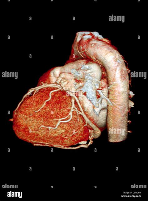 Normal Heart 3d Ct Scan Stock Photo Alamy