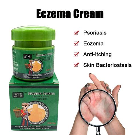Miao Herbal Psoriasis Cream Anti Itch Antibacterial Creams Relief