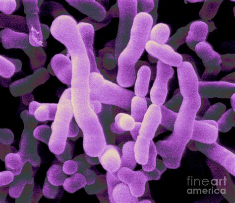 Bifidobacterium Pullorum Photograph By Scimat Fine Art America