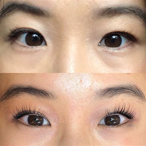 All brow lift before and after photos are of patients who have given consent for their images to be published on this site. Lash Lift Before and After | Lash lift, Permed hairstyles ...