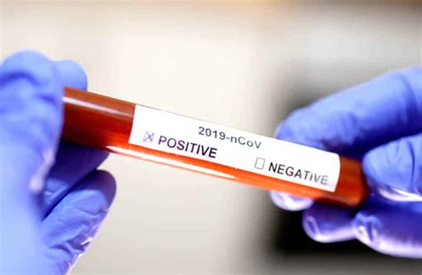 Rapid test corona gratis bagi peserta ujian masuk ptn. Israel envía 200 kits de prueba de coronavirus a Gaza