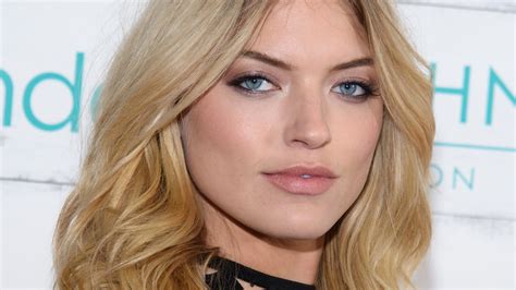 Free People Model Martha Hunt Opens Up About Scoliosis And How It Makes