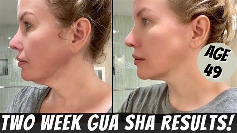 Neck Lift Without Surgery Incredible 2 Week Gua Sha Transformation