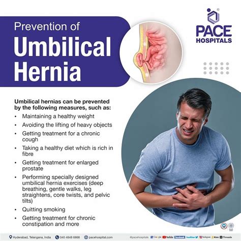 Umbilical Hernia Symptoms Causes Complications And Prevention