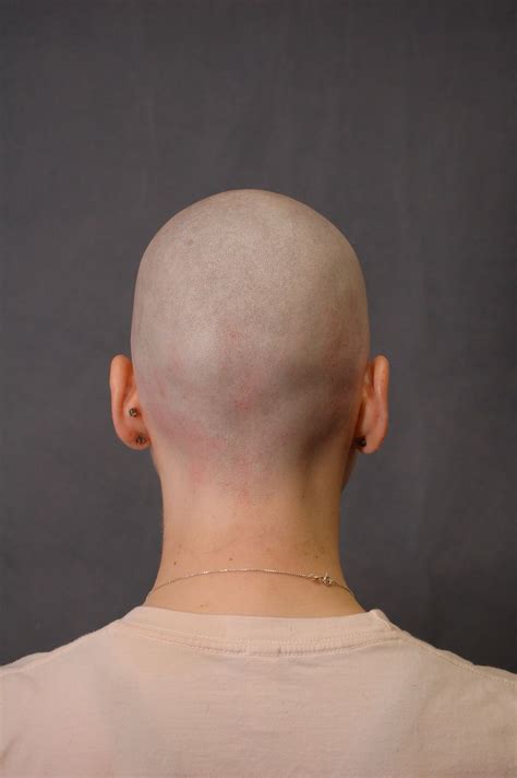 Bald Woman Head Back View Bald Women Bald Person Bald Girl