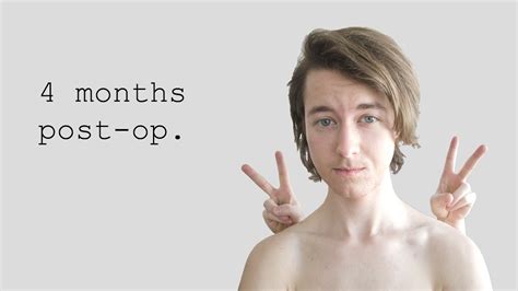 Ftm 4 Months Post Op Youtube