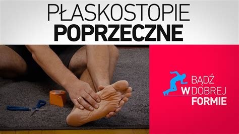 Płaskostopie poprzeczne KINESIOTAPING YouTube