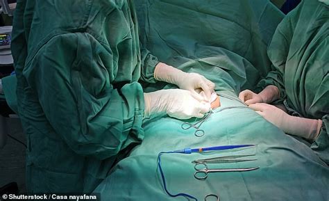 Man Is Forced To Pay His Surgeons £6400 During A Circumcision