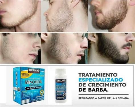 Como Usar Minoxidil Na Barba → Passo A Passo E Dicas