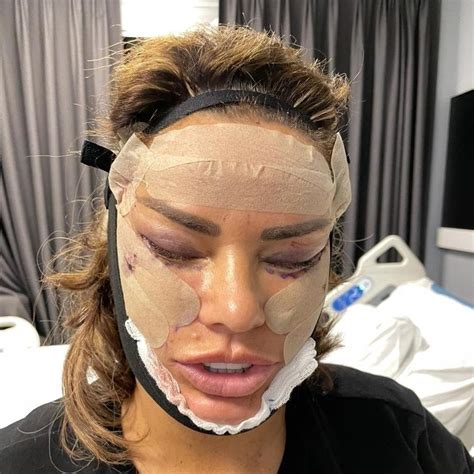 Katie Price Unveils Brand New Face After Facelift Surgery Au — Australias Leading