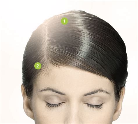 La perte de cheveux comprend toutes les causes de chute passagère : Perte de cheveux important femme