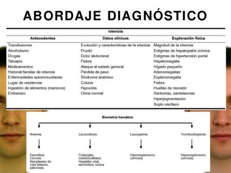 Ictericia