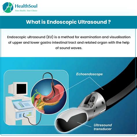 Endoscopic Ultrasound Indications And Complications Healthsoul