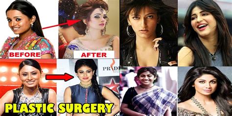 top 10 plastic surgery of popular tv actress before after photos the stylish life