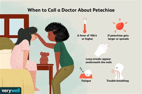 Petechiae Symptoms Causes Treatment