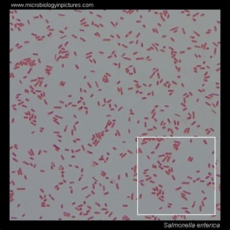 Salmonella Enterica Micrograph Img Omnom