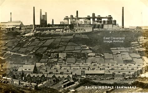 Skinningrove Ironworks East Cleveland Image Archive