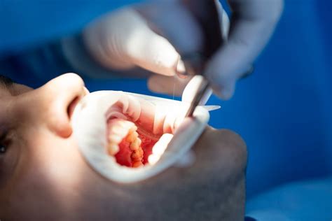 Oral And Maxillofacial Surgery Dent Master Smile