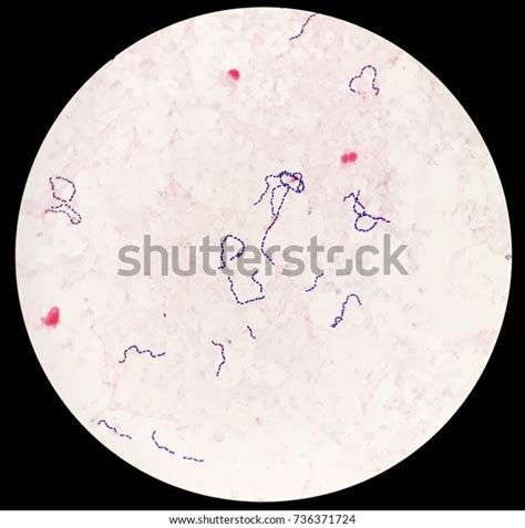 Smear Human Blood Culture Grams Stained Stock Photo