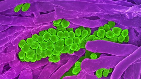 Saliva And Bacteria Animated Coloured Scanning Electron Micrograph