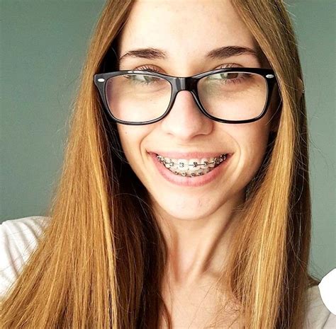 Bracefaced Exotic Teen With Braces Telegraph