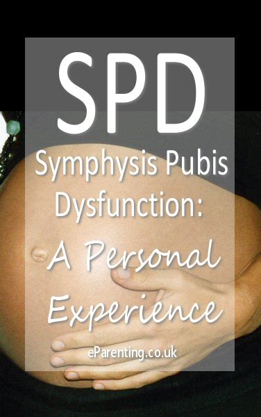 Spd Symphysis Pubis Dysfunction During Pregnancy