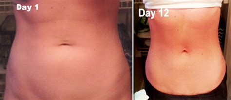 Weight Loss Tip To Give You A Flatter Stomach Quick In Just 12 Days