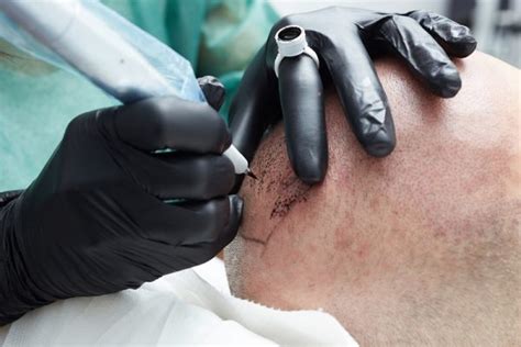 Scalp Micropigmentation What To Know Organic Permanent Makeup
