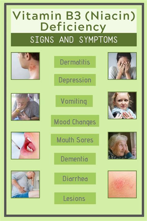 Niacin B3 Deficiency Symptoms And Solutions Mcisaac Health Systems