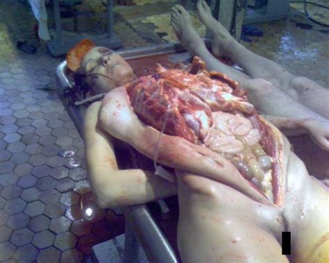 【閲覧注意】女の子の全裸遺体の処女膜を破った写真、もはや炎上どころではない・・・（画像あり） ポッカキット